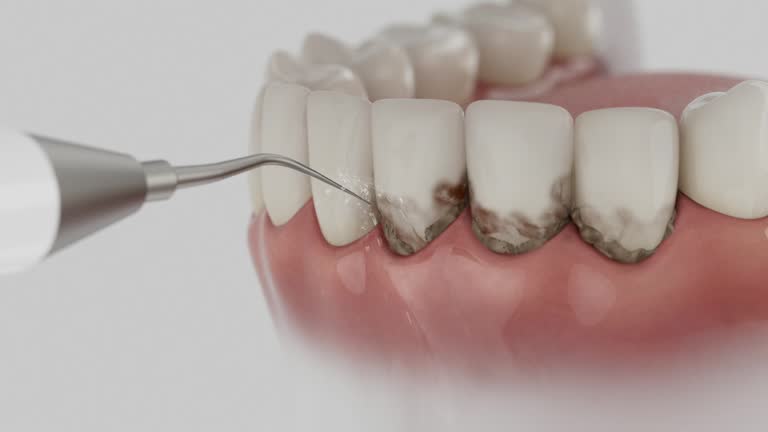 Reliable Dental Implants contractor in Sorgho, KY by Smile Center Dentistry